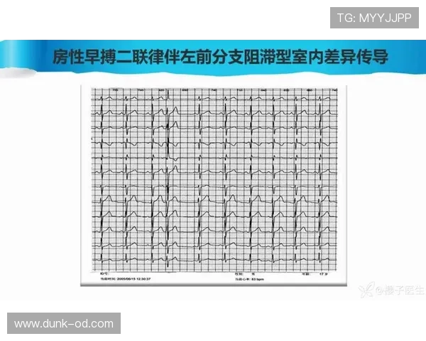 莱奥突破与终结效率的结构性差异解析